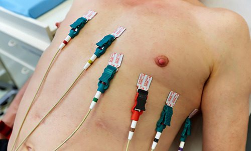 What Is An Electrocardiogram 